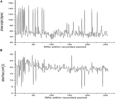 Reverse Trigger in Ventilated Non-ARDS Patients: A Phenomenon Can Not Be Ignored!